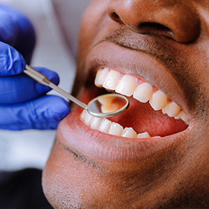Emergency Dentist in Slidell
